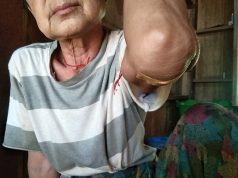 ခီဖျိကတၢၢ်တံာ်(BGF)သုးကလၢၤခးလီၤကျိဖးဒိၣ်အဃိလီၢ်က၀ီၤဖိဘၣ်ဒိ(၂)ဂၤ