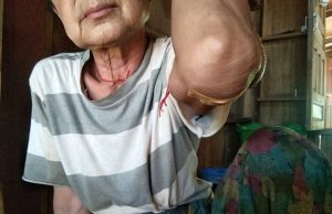 ခီဖျိကတၢၢ်တံာ်(BGF)သုးကလၢၤခးလီၤကျိဖးဒိၣ်အဃိလီၢ်က၀ီၤဖိဘၣ်ဒိ(၂)ဂၤ
