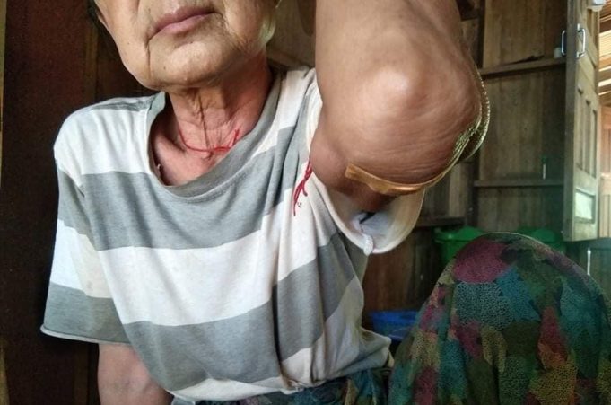 ခီဖျိကတၢၢ်တံာ်(BGF)သုးကလၢၤခးလီၤကျိဖးဒိၣ်အဃိလီၢ်က၀ီၤဖိဘၣ်ဒိ(၂)ဂၤ