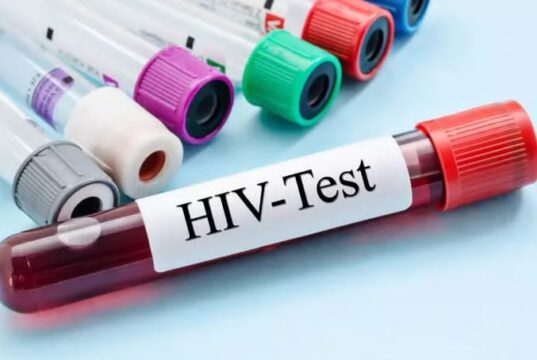 လၢတၢ်မၤလီၤစှၤ(HIV)တၢ်ဘၣ်ကူဘၣ်ဂၥ်အဂီၢ် သုးကရူၢ်ကဟံးန့ၢ် ပှၤဆါလီၤအီၣ်သးတဖၣ်အရ့